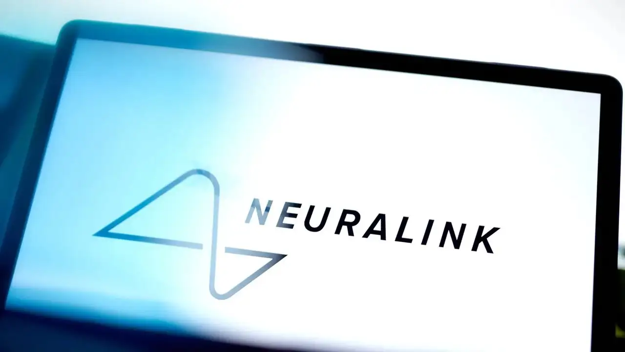 Neuralink ҳар йили 20 минг беморга нейрочип ўрнатмоқчи