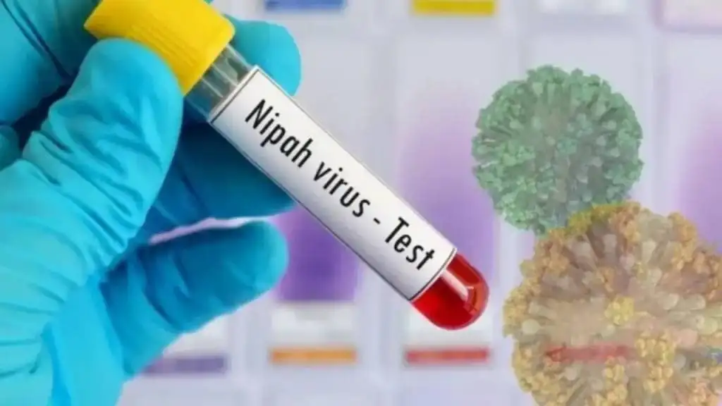 “Nipah” virusiga qarshi vaksina ishlab chiqarildi